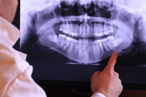 Best Dental Abscess Treatment in Baraga, MI