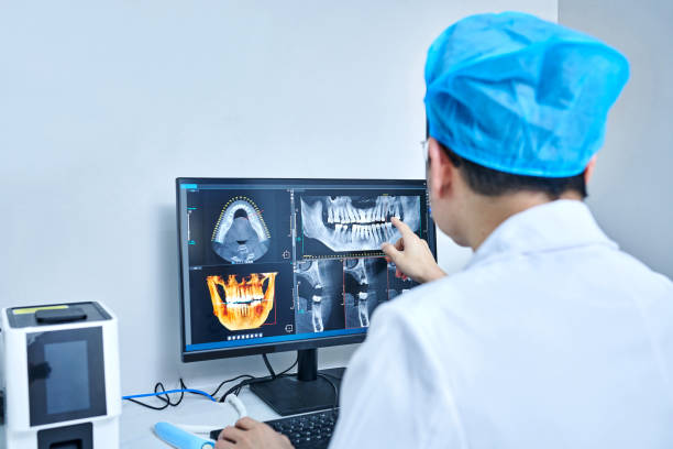 Best Knocked-Out Tooth (Avulsed Tooth) Treatment in Baraga, MI