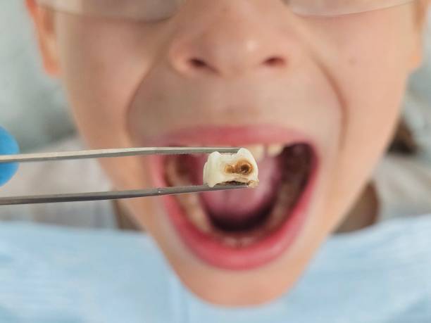Best Emergency Pediatric Dental Care in Baraga, MI